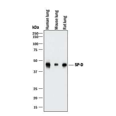 Detection of Human, Mouse, and Rat SP-D antibody by Western Blot.