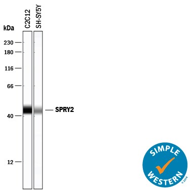 Detection of Human and Mouse SPRY2 antibody by Simple WesternTM.