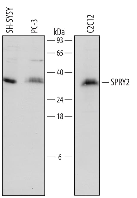 Detection of Human and Mouse SPRY2 antibody by Western Blot.