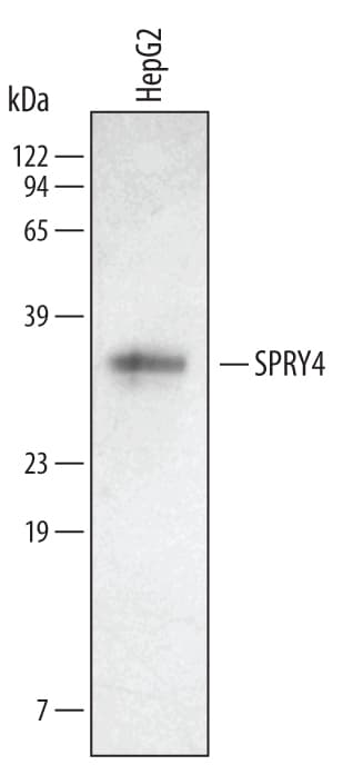 Detection of Human SPRY4 antibody by Western Blot.