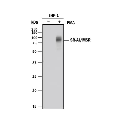 Detection of Human SR-AI/MSR antibody by Western Blot.