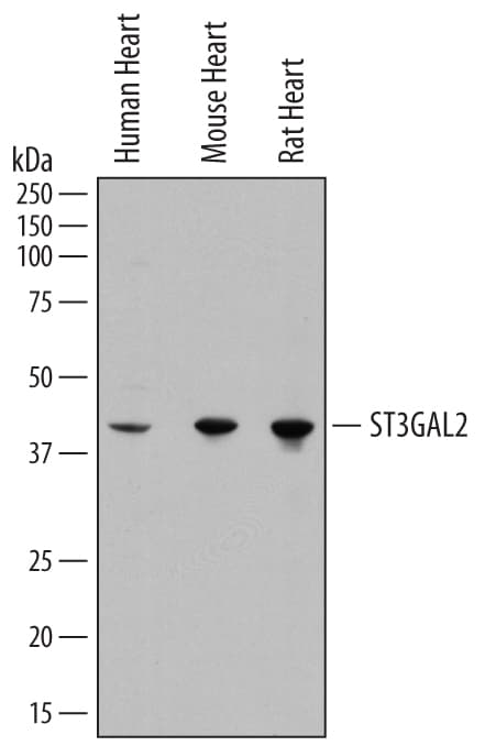 Detection of Human, Mouse, and Rat ST3  beta -Gal a-2,3-Sialyltransferase 2/ST3GAL2 antibody by Western Blot.