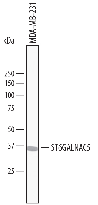 Detection of Human GalNAc a-2,6 sialyltransferase V/ ST6GALNAC5 antibody by Western Blot.
