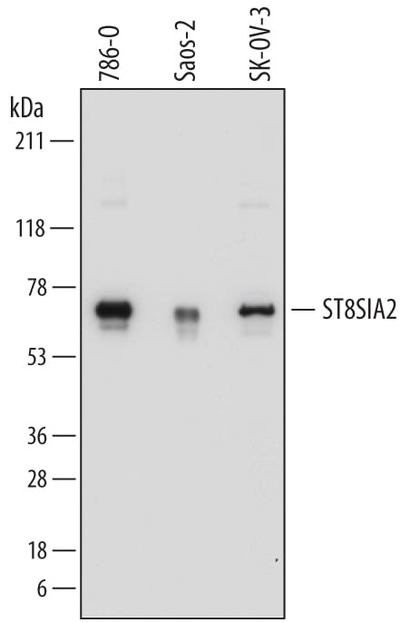 Detection of Human a-2,8-Sialyltransferase 8B/ST8SIA2 antibody by Western Blot.