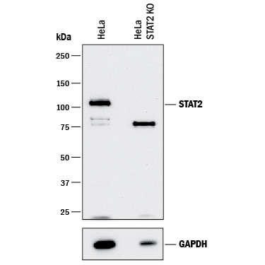 Western Blot Shows Human STAT2 Antibody Specificity by Using Knockout Cell Line.
