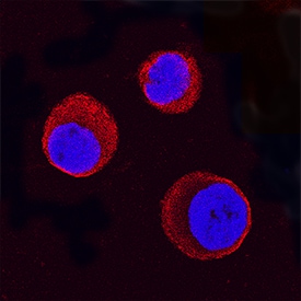 STAT5a antibody in K562 Human Cell Line by Immunocytochemistry (ICC).