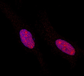 Phospho-STAT5a/b (Y694/Y699) antibody in HeLa Human Cell Line by Immunocytochemistry (ICC).