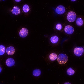 Phospho-STAT6 Y641 antibody in U937 Human Cell Line by Immunocytochemistry (ICC).