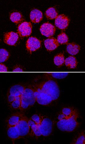 Phospho-STAT6 (Y641) antibody in Daudi Human Cell Line by Immunocytochemistry (ICC).