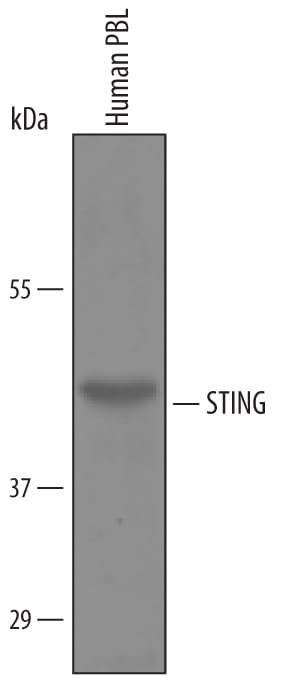 Detection of Human STING/TMEM173 antibody by Western Blot.