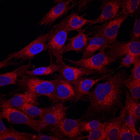 STRO-1 antibody in Human MG-63 Cell Line by Immunocytochemistry (ICC).