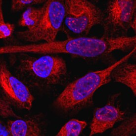 SUZ12 antibody in HeLa Human Cervical Epithelial Carcinoma Cell Line by Immunocytochemistry (ICC).