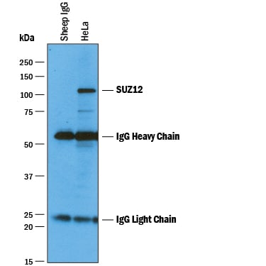 Immunoprecipitation of Human SUZ12.
