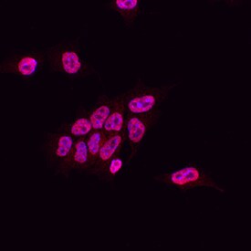 SUZ12 antibody in D3 Mouse Cell Line by Immunocytochemistry (ICC).