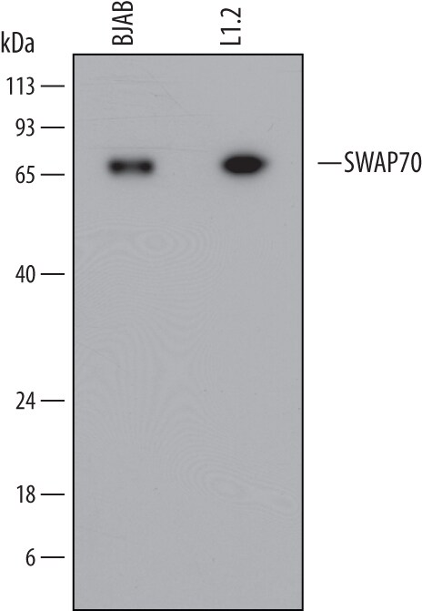 Detection of Human and Mouse SWAP70 antibody by Western Blot.