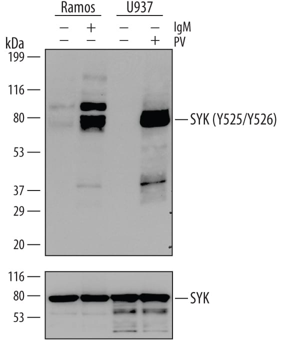 Detection of Human Phospho-SYK (Y525/Y526) antibody by Western Blot.
