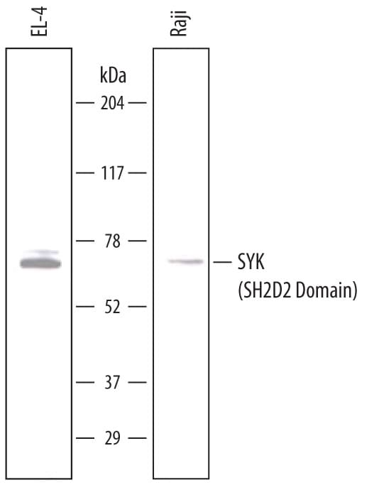 Detection of Human and Mouse SYK (SH2D2 Domain) antibody by Western Blot.