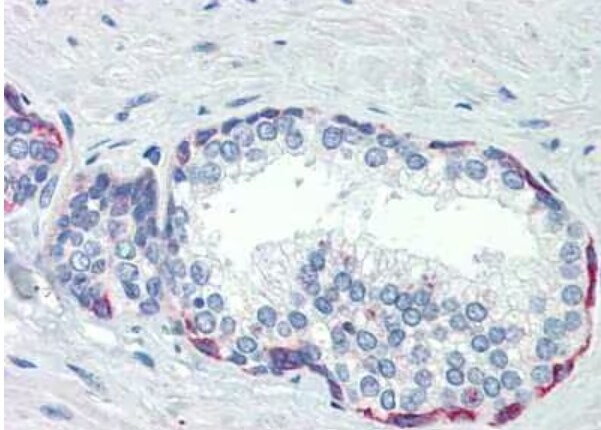 Immunohistochemistry: PLEKHH2 Antibody [NBP1-70677]