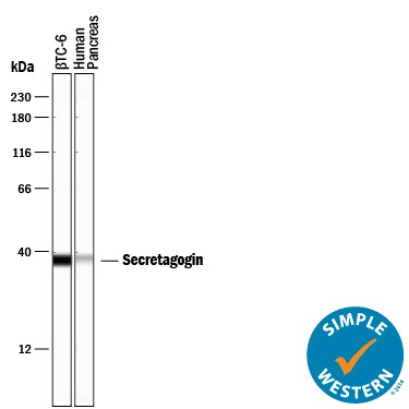 Detection of Human and Mouse Secretagogin antibody by Simple WesternTM.