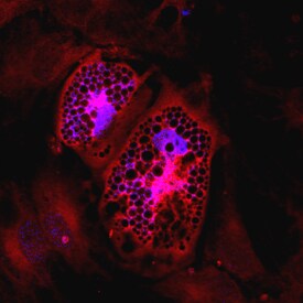 Seipin/BSCL2 antibody in Human Mesenchymal Stem Cells by Immunocytochemistry (ICC).