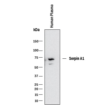 Detection of Human Serpin A1/a1-Antitrypsin antibody by Western Blot.