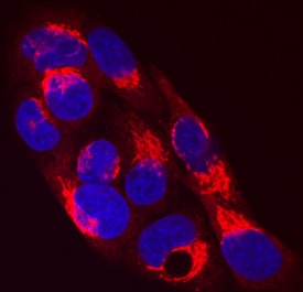 Serpin A1/a1-Antitrypsin antibody in HepG2 Human Cell Line by Immunocytochemistry (ICC).