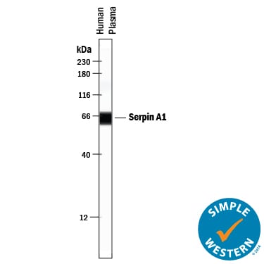 Detection of Human Serpin A1/a1-Antitrypsin antibody by Simple WesternTM.