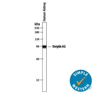 Detection of Human Serpin A1/a1-Antitrypsin antibody by Simple WesternTM.