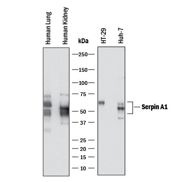 Detection of Human Serpin A1/a1-Antitrypsin antibody by Western Blot.