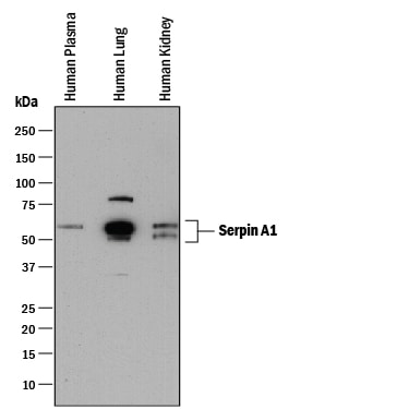 Detection of Human Serpin A1/a1‑Antitrypsin antibody by Western Blot.