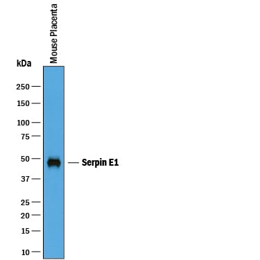 Detection of Mouse Serpin E1/PAI-1 antibody by Western Blot.