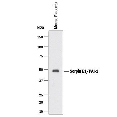 Detection of Mouse Serpin E1/PAI-1 antibody by Western Blot.