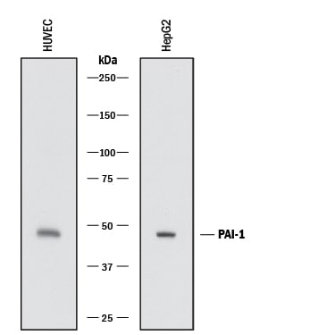 Detection of Human Serpin E1/PAI‑1 antibody by Western Blot.