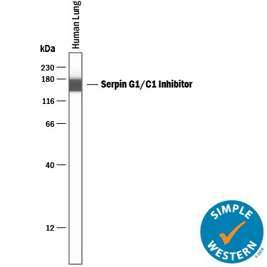 Detection of Human Serpin G1/C1 Inhibitor antibody by Simple WesternTM.