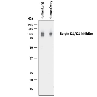 Detection of Serpin G1/C1 Inhibitor antibody by Western Blot.