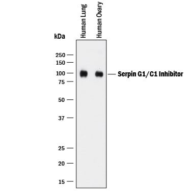 Detection of Serpin G1/C1 Inhibitor antibody by Western Blot.