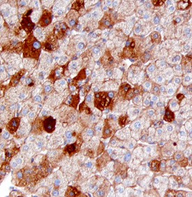 Serum Amyloid A4 antibody in Human Liver by Immunohistochemistry (IHC-P).