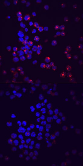 Phospho-Siglec-2/CD22 (Y822) antibody in Raji Human Cell Line by Immunocytochemistry (ICC).