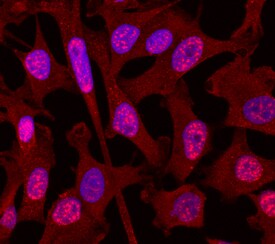 Smad3 antibody in MDA-MB-231 Human Cell Line by Immunocytochemistry (ICC).