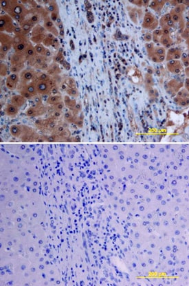 Smad7 antibody in Human Liver by Immunohistochemistry (IHC-P).