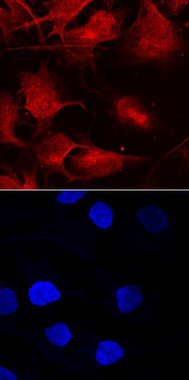 Smad9 antibody in A172 Human Cell Line by Immunocytochemistry (ICC).