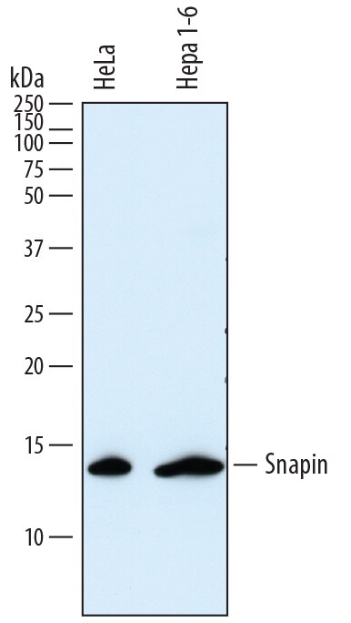 Detection of Human and Mouse Snapin antibody by Western Blot.