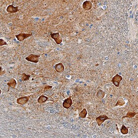SorCS2 antibody in Human Brain by Immunohistochemistry (IHC-P).