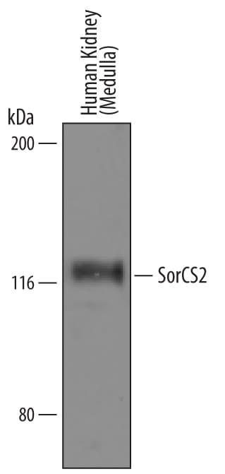 Detection of Human SorCS2 antibody by Western Blot.