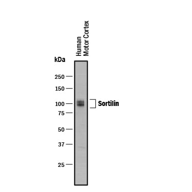 Detection of Human Sortilin antibody by Western Blot.