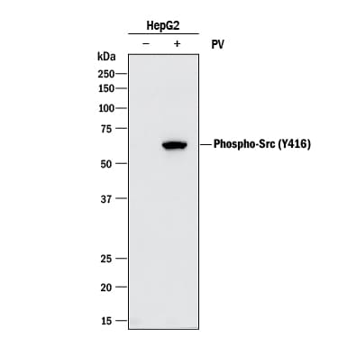 Detection of Human Src antibody by Western Blot.