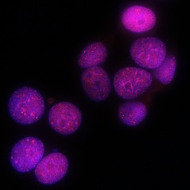 Survivin antibody in MCF-7 Human Cell Line by Immunocytochemistry (ICC).