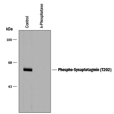 Detection of Phospho-Synaptotagmin-1 (T202) antibody by Western Blot.