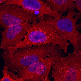 Syndecan-4 antibody in HeLa Human Cervical Epithelial Carcinoma Cell Line by Immunocytochemistry (ICC).