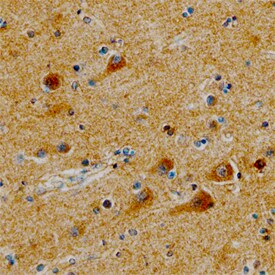 Syntaxin 6 antibody in Human Brain by Immunohistochemistry (IHC-P).